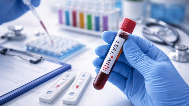 best HIV test in Dubai