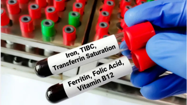 Iron Deficiency test in Dubai
